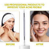 Professional Tool to Improve your Acne Proble, Ultra Fine Round Loop