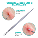 Pimple Extractor Acne Treatment Tool Surgical Grade Blackhead Comedone Removal